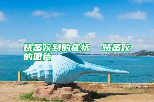 跳蚤咬到的癥狀  跳蚤咬的圖片